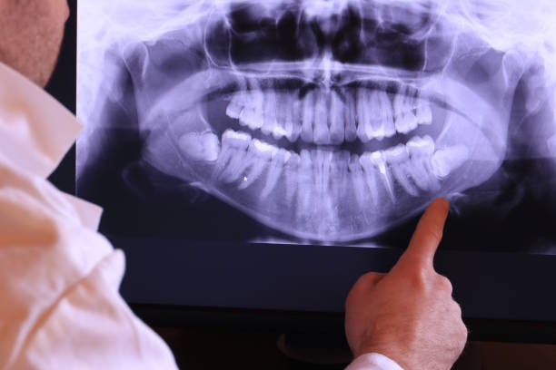 Best Emergency Gum Treatment in Rowlett, TX