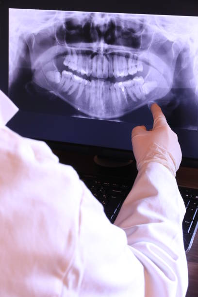 Best Emergency Wisdom Teeth Removal in Rowlett, TX